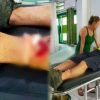 Kritik Pemerintah Lewat Insiden Turis Kecelakaan di Trotoar