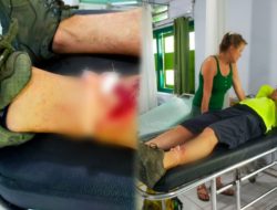 Kritik Pemerintah Lewat Insiden Turis Kecelakaan di Trotoar