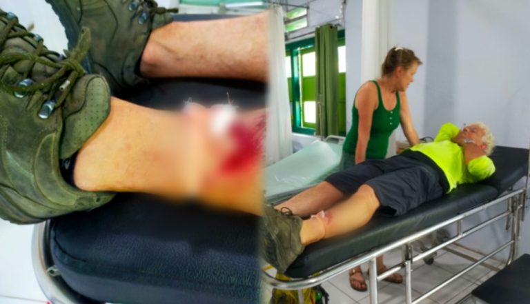 Kritik Pemerintah Lewat Insiden Turis Kecelakaan di Trotoar