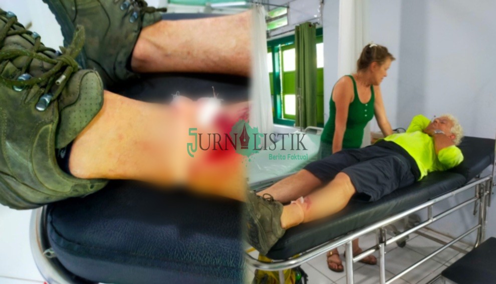 Kritik Pemerintah Lewat Insiden Turis Kecelakaan di Trotoar