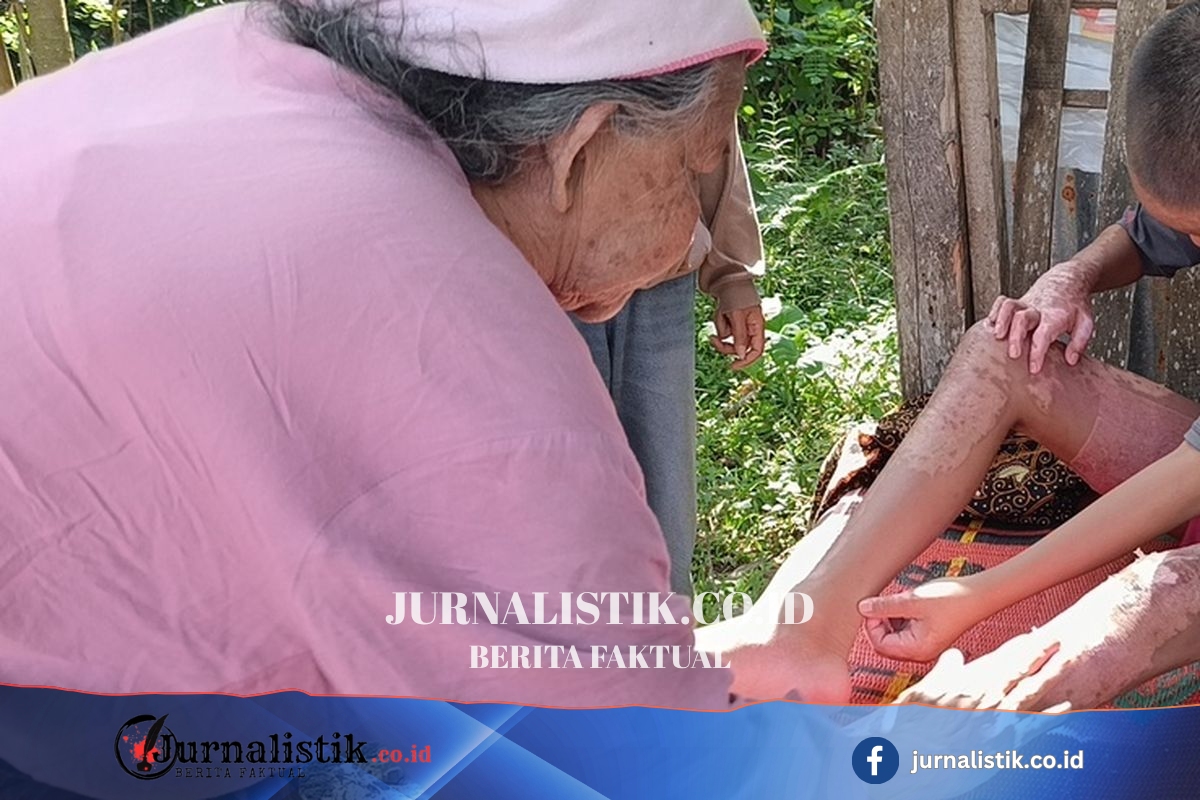 Kerap Dibully, Santri yang Diduga Dibakar Teman Pilih Keluar dari Ponpes Regional 7 Juni 2026