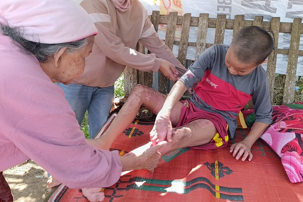 Urutan Kejadian 3 Santri di Lombok Tengah Diduga Dibakar Senior, Berawal dari Kamar Kosong yang Dikunci Regional 5 Juni 2026