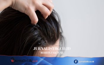 Ketombe dan Kulit Kepala Gatal: Benarkah Mengarah ke Rambut Rontok?