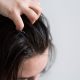 Ketombe dan Kulit Kepala Gatal: Benarkah Mengarah ke Rambut Rontok?
