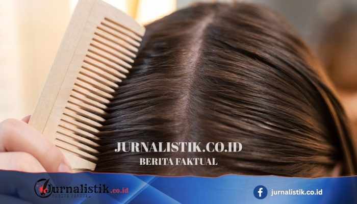 Penyebab Rambut Cepat Lepek: Kulit Kepala Berminyak dan Cara Menanganinya
