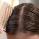 Penyebab Rambut Cepat Lepek: Kulit Kepala Berminyak dan Cara Menanganinya