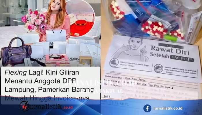 Dhea Adita Aprilia, Menantu DPRD Lampung Tengah, Pamer Tas Mewah & Bukti Operasi Plastik Rp67,7 Juta Viral