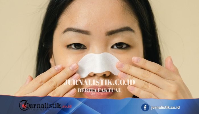 Panduan Mengatasi Komedo Membandel dari Dokter Kulit
