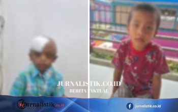 Sidikalang: Dua Bocah Diduga Disiksa Bibinya, Polres Dairi Selidiki Motif