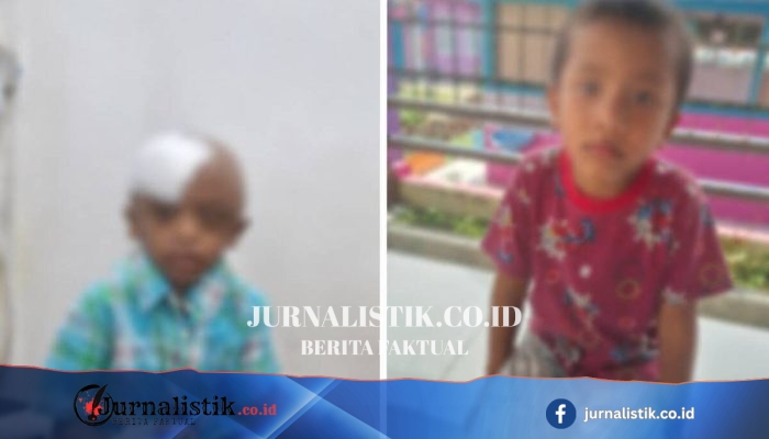 Sidikalang: Dua Bocah Diduga Disiksa Bibinya, Polres Dairi Selidiki Motif