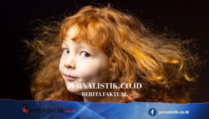 Gingers of America: Skotlandia di balik potret pemilik rambut merah di Amerika