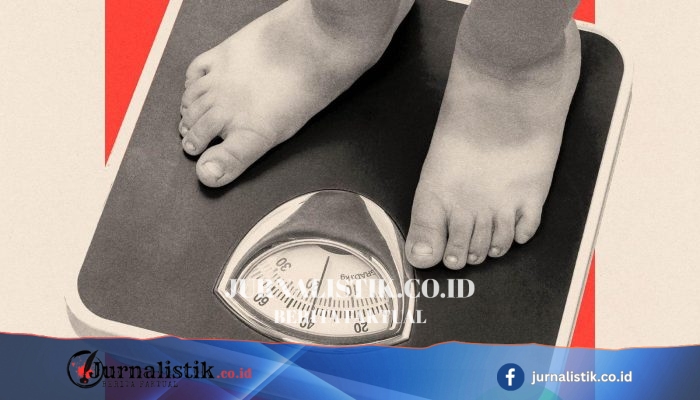 Faktor yang Terlewat: Absensi Sekolah dan Krisis Obesitas Anak